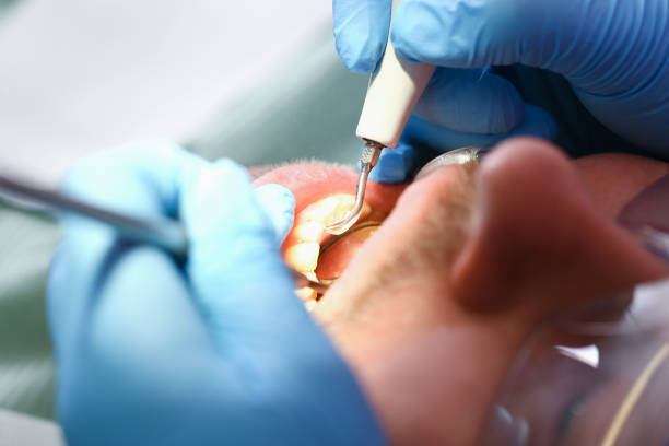 Best Emergency TMJ Treatment in Bonneau Beach, SC